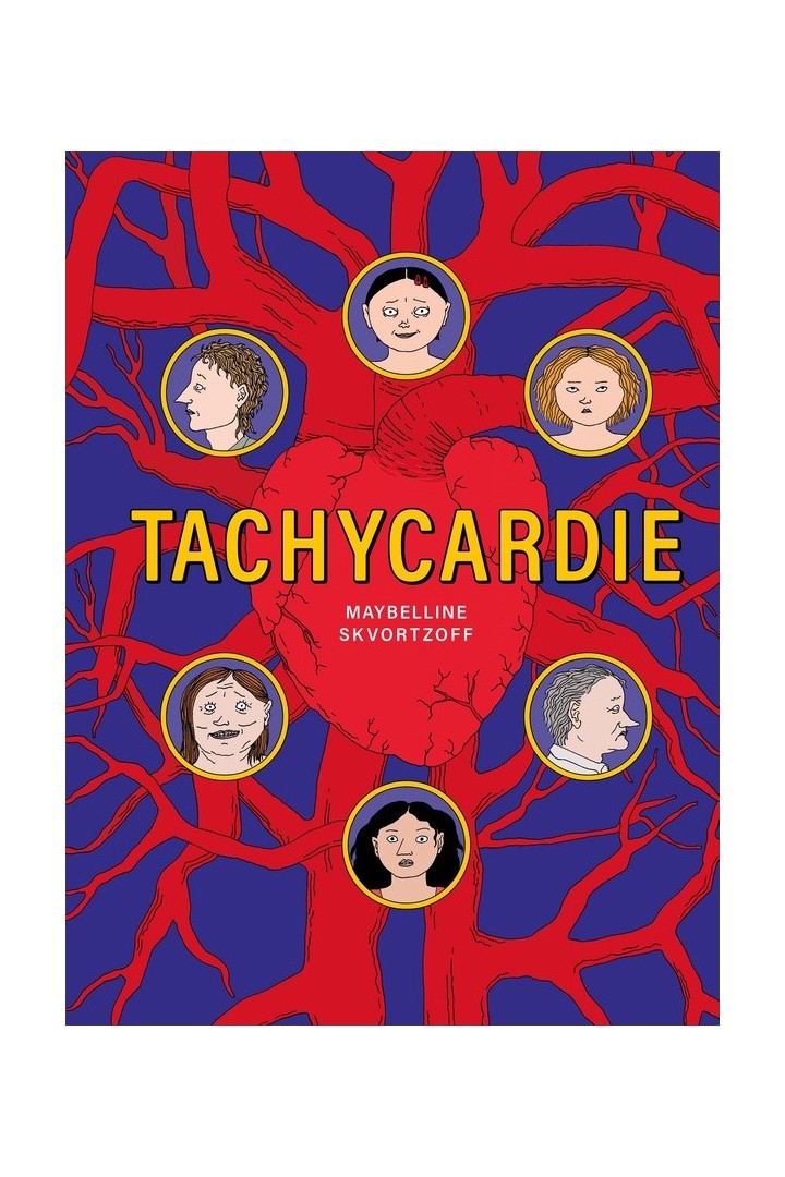 Tachycardie